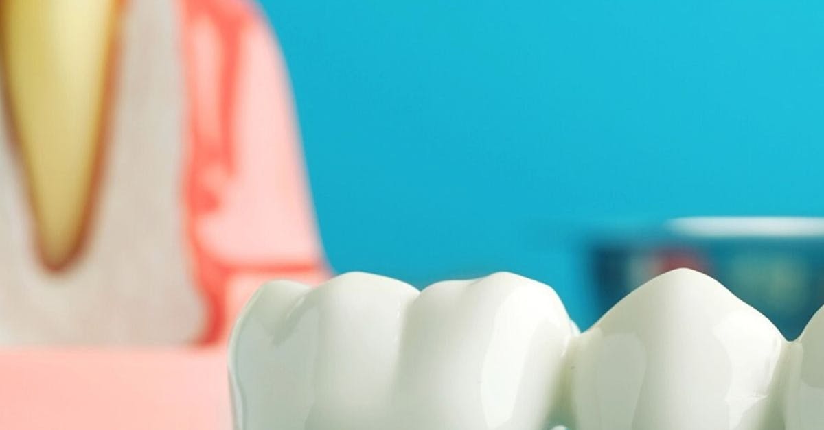 Affordable Dental Care Options with Implants  