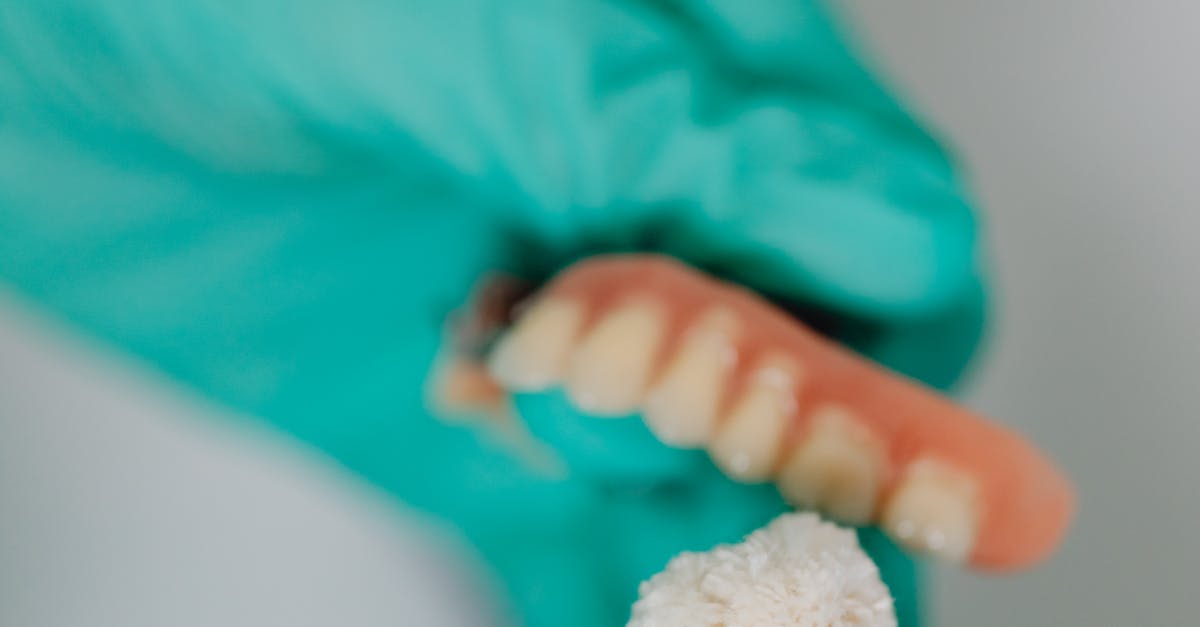 Financing Options for Tooth Implants in Turkey  